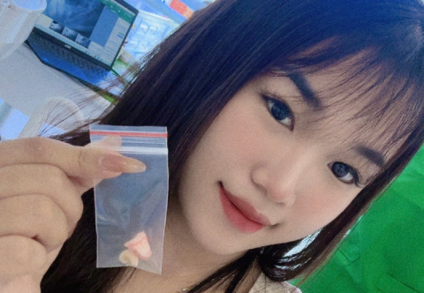 Sau khi nhổ răng khôn bao lâu thì được ăn, cần kiêng gì